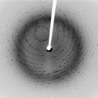 Figure 14: An x-ray diffraction pattern.