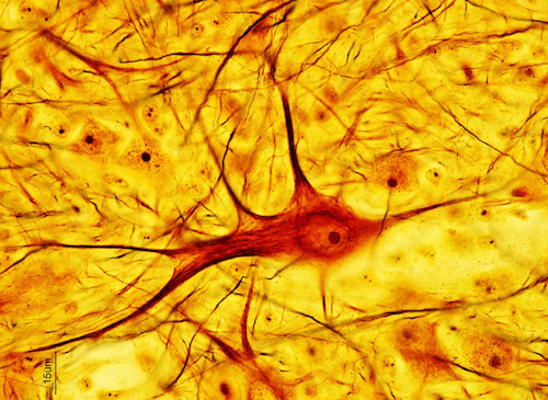 Figure 3: Neuron cell structures dyed with the 