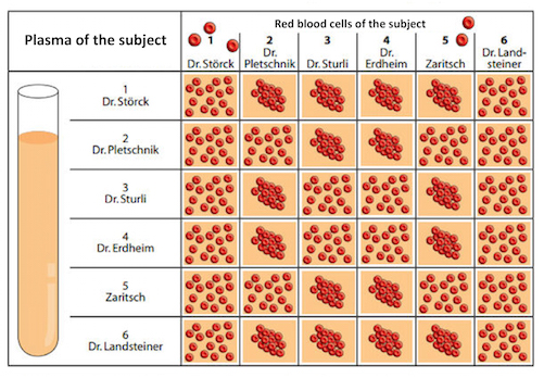 Figure 6: This table illustrates the results of Karl Landsteiner's 1901 experiment using his research group as subjects. Landsteiner mixed the blood cells and sera of his employees and, using a microscope, observed whether there was clumping.