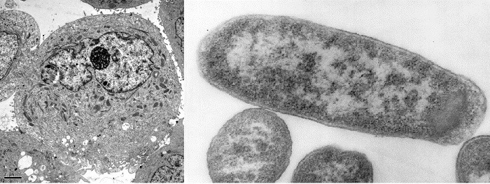 eukaryote and prokaryote