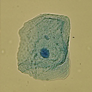 cheek cell
