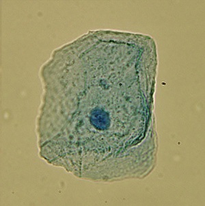 Figura 5: El núcleo que contiene ADN es claramente visible en esta célula eucariota. 

