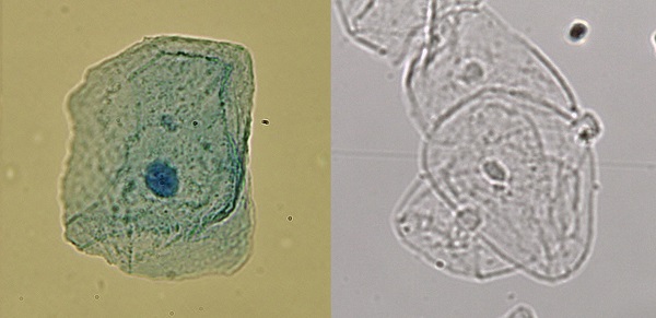 Figura 3: Células teñidas (izq) y células desteñidas (der)