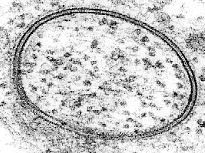 Figure 1: An electron micrograph showing the double-membrane.