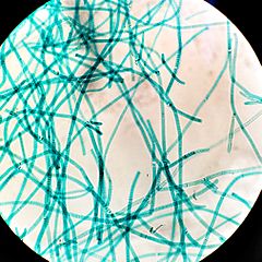 Figure 1: Live phytoplankton called cyanobacteria are thought to be similar to the primitive bacteria identified by Schopf.