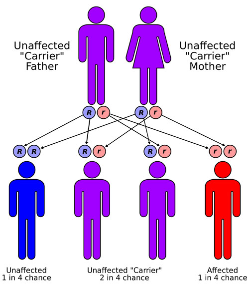 Figure 4: Garrod theorized that the diseases he studied, including Tay-Sachs disease, were inherited from the parents.  He correctly believed the diseases were caused by a recessive gene in the children was causing an enzyme deficiency.