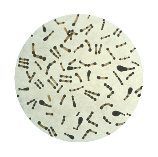 Figure 5: Photomicrograph of Corynebacterium diphtheriae.